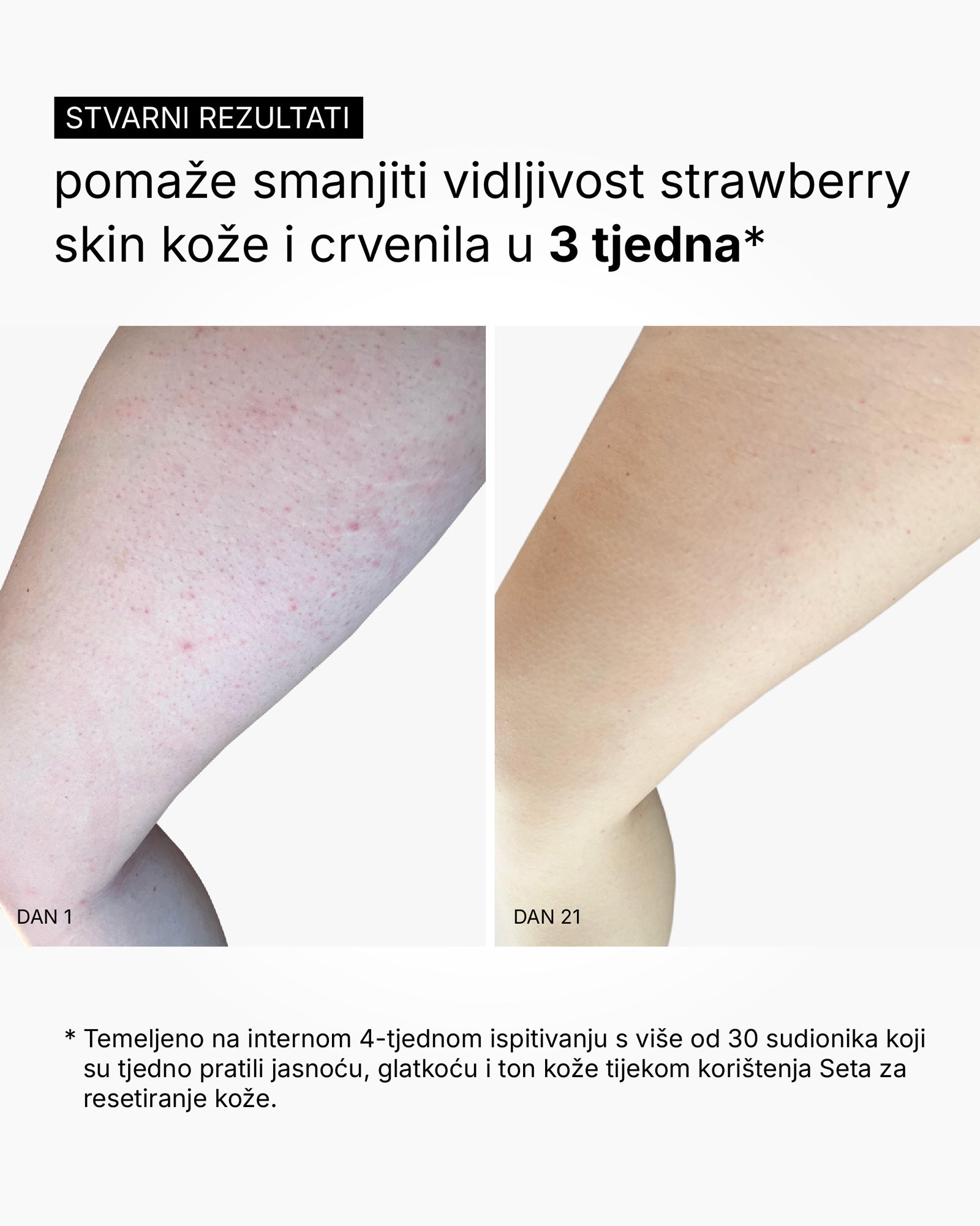 Skin Reset Set - Routine corps complète