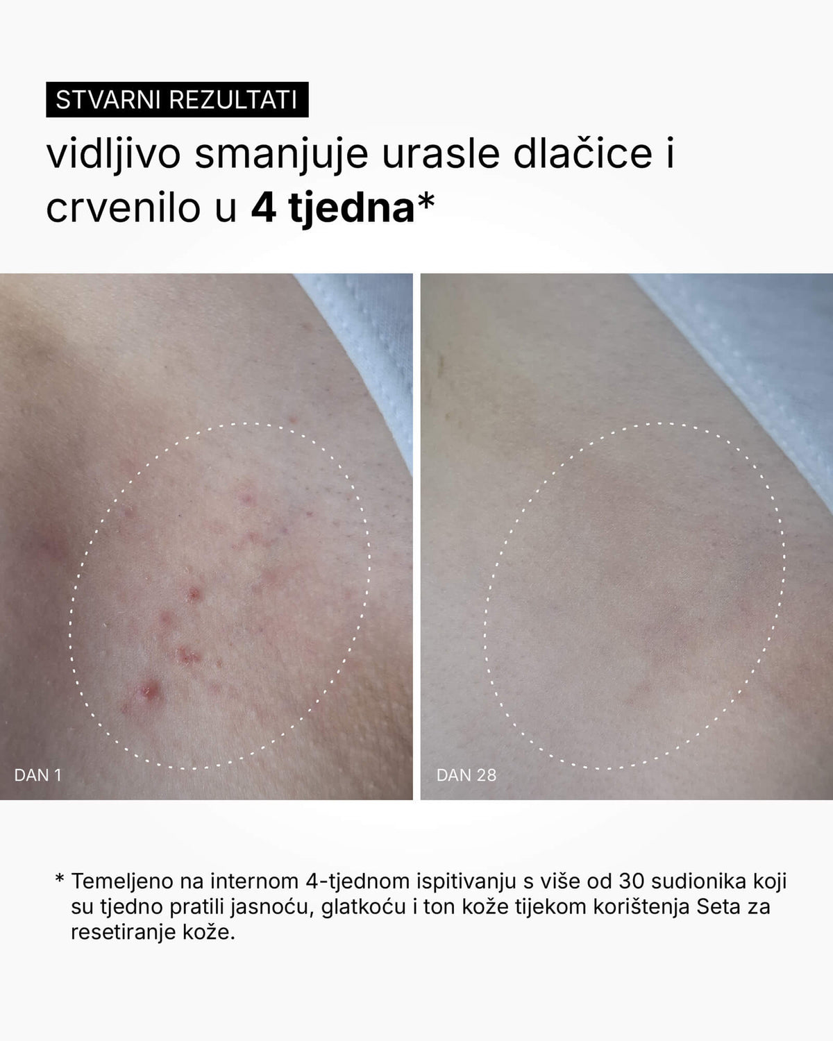 Skin Reset Set - Routine corps complète