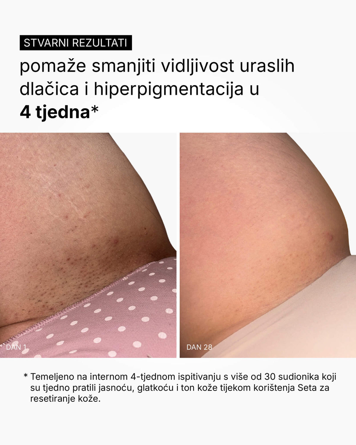 Skin Reset Set - Routine corps complète
