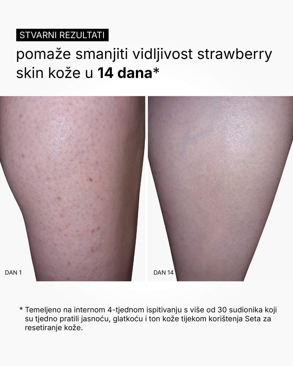 Skin Reset Set - Routine corps complète