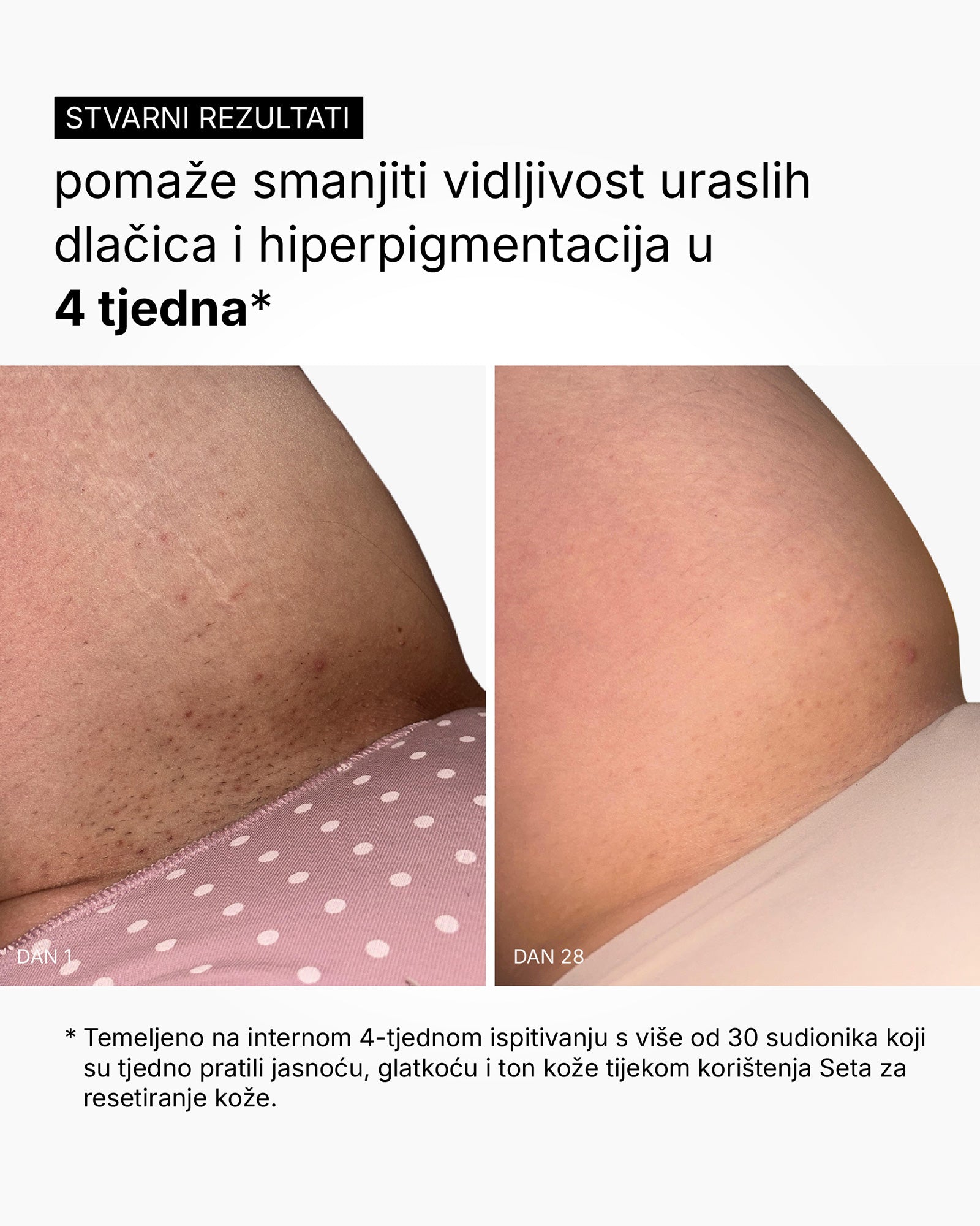Skin Reset Set - Routine corps complète